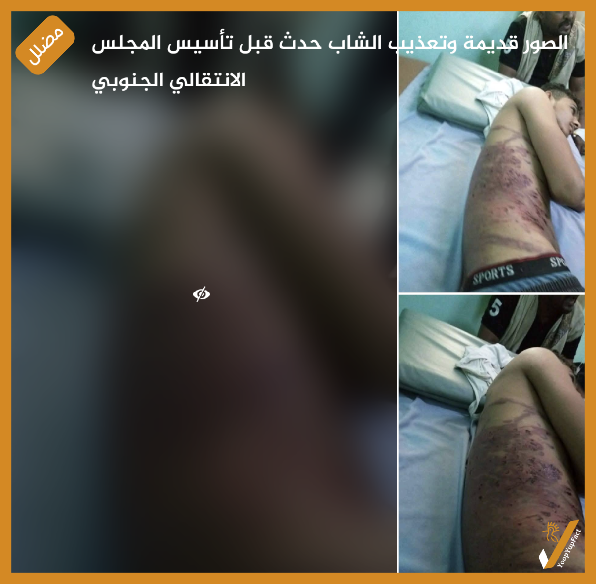 الصور قديمة وتعذيب الشاب حدث قبل تأسيس المجلس الانتقالي الجنوبي